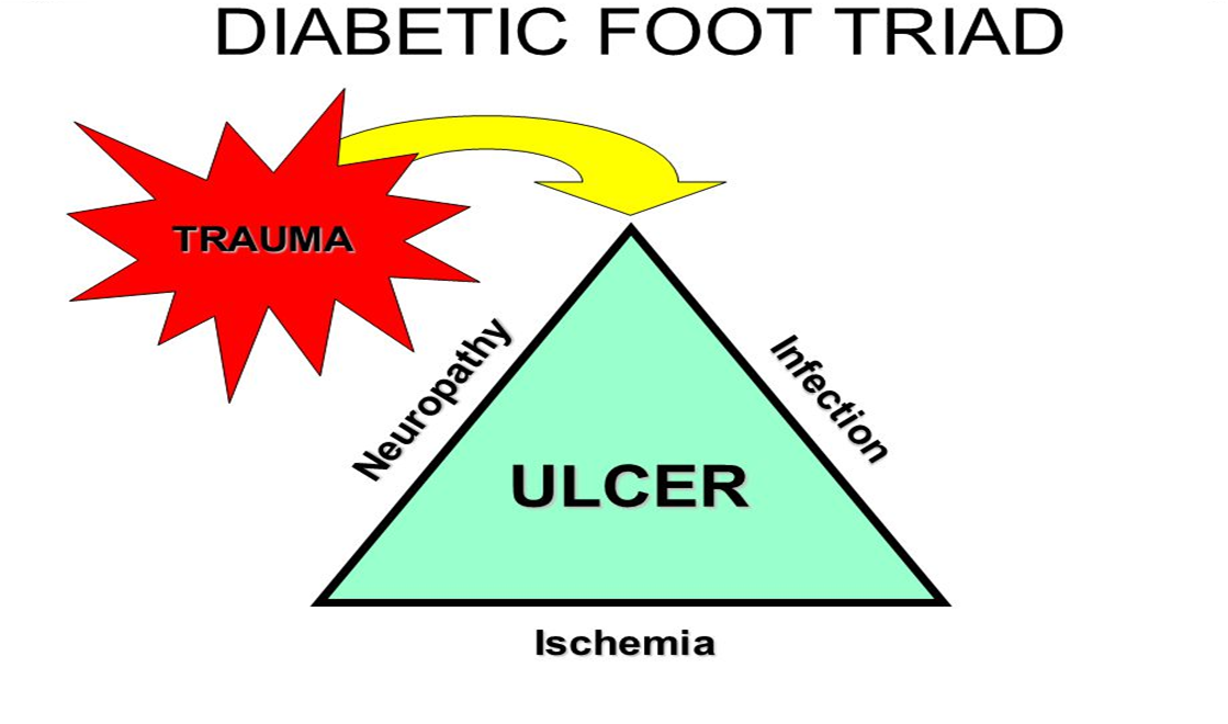 Treatment​ of diabeticfoot problems