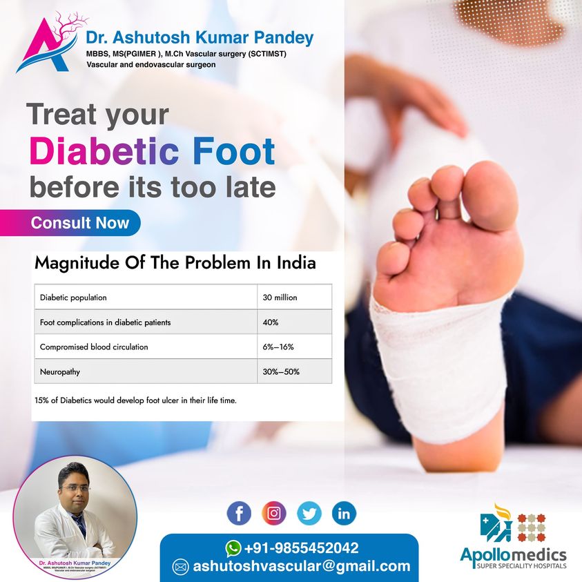 Diabetic foot doctor in Lucknow