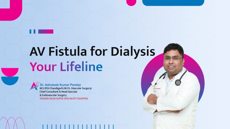 vascular-surgeon-in-lucknow