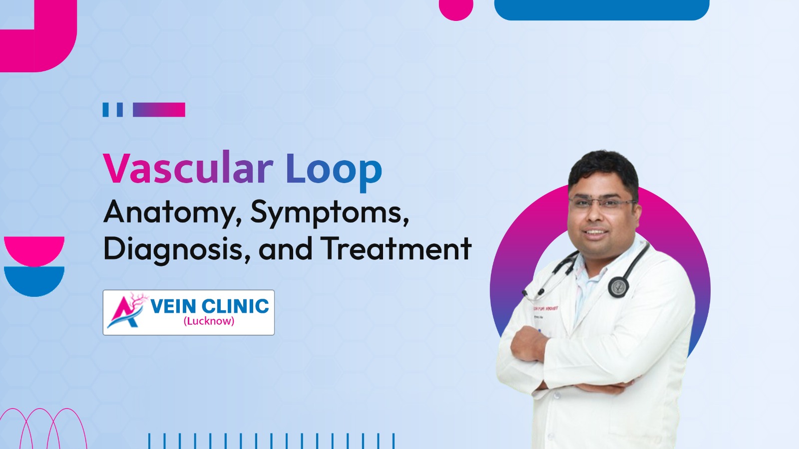 Vascular Loop: Anatomy, Symptoms, Diagnosis, and Treatment
